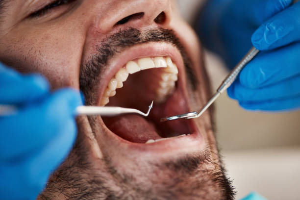 Best Emergency Treatment for Dental Infections or Abscesses in Williston, FL